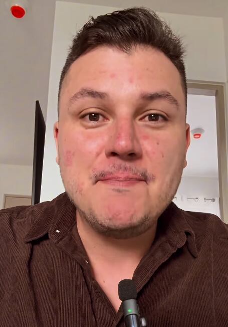 Josué Sánchez habló con el corazón hace unas semanas sobre la lucha que enfrenta y este martes mostró las secuelas que paga por eso