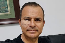 Experiodista de Telenoticias fue operado de un tumor en su rostro