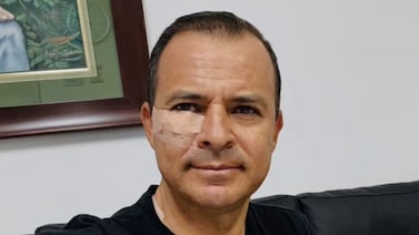 Experiodista de Telenoticias fue operado de un tumor en su rostro