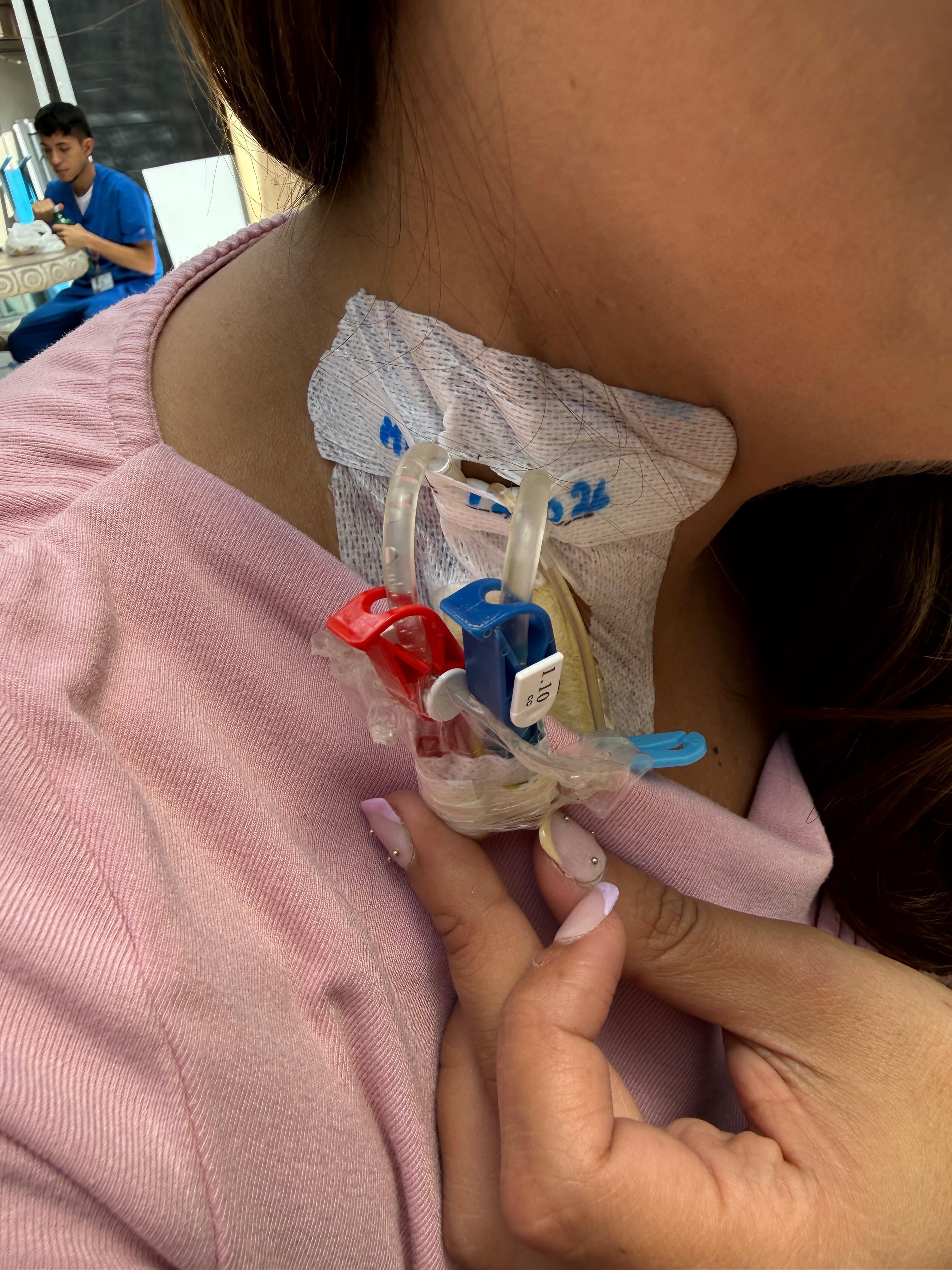 Geannina Zuniga Herrera (Nina) vive sin los dos riñones por culpa de una bacteria la cual se los llevó en 5 días: “Soy un milagro total”.
