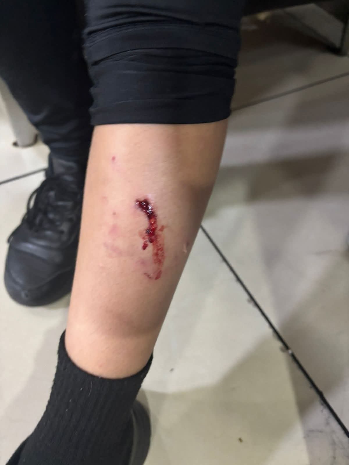 Niño de 7 años fue atacado por un perro en Multiplaza