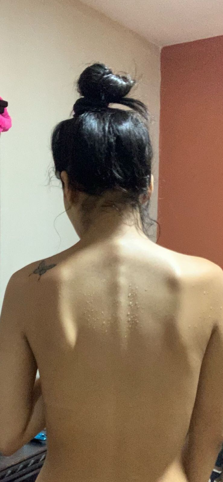 Nahomy Baltodano Ruiz, en el 2020, con 17 años, luchó contra la anorexia nerviosa y pasó de 70 kilos a 45, terminó internada en el Psiquiátrico y hasta sintió la muerte, pero logró superar su trastorno alimenticio.