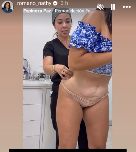 Natalia Romano, hermana de Choché Romano, se operará de nuevo.