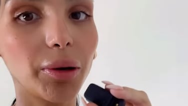 Nicole “Coco” Roper cuenta cómo sigue su salud tras enfrentar varias complicaciones