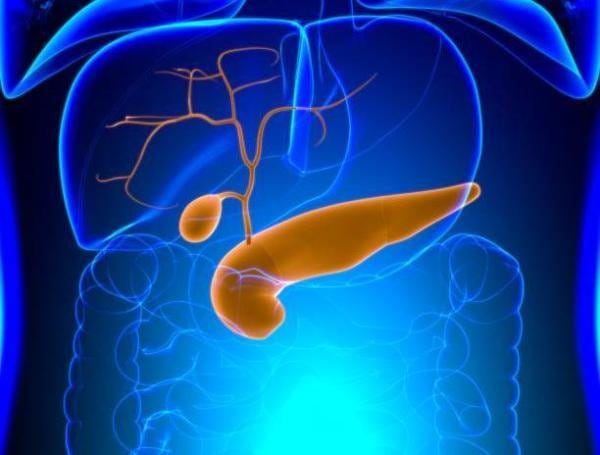 cáncer de páncreas