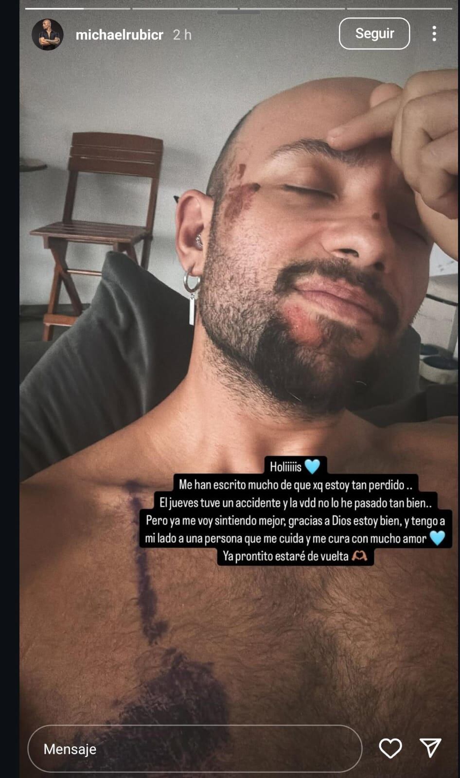Michael Rubí tras su accidente