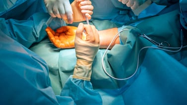 Esperó durante dos años una cirugía y cuando al fin la tuvo, le operaron el dedo equivocado