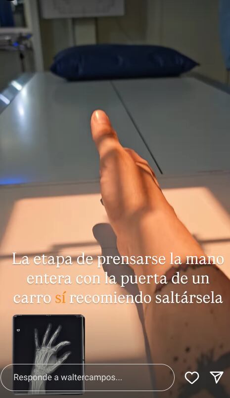 El presentador Wálter Campos se llevó un pequeño susto en su mano derecha