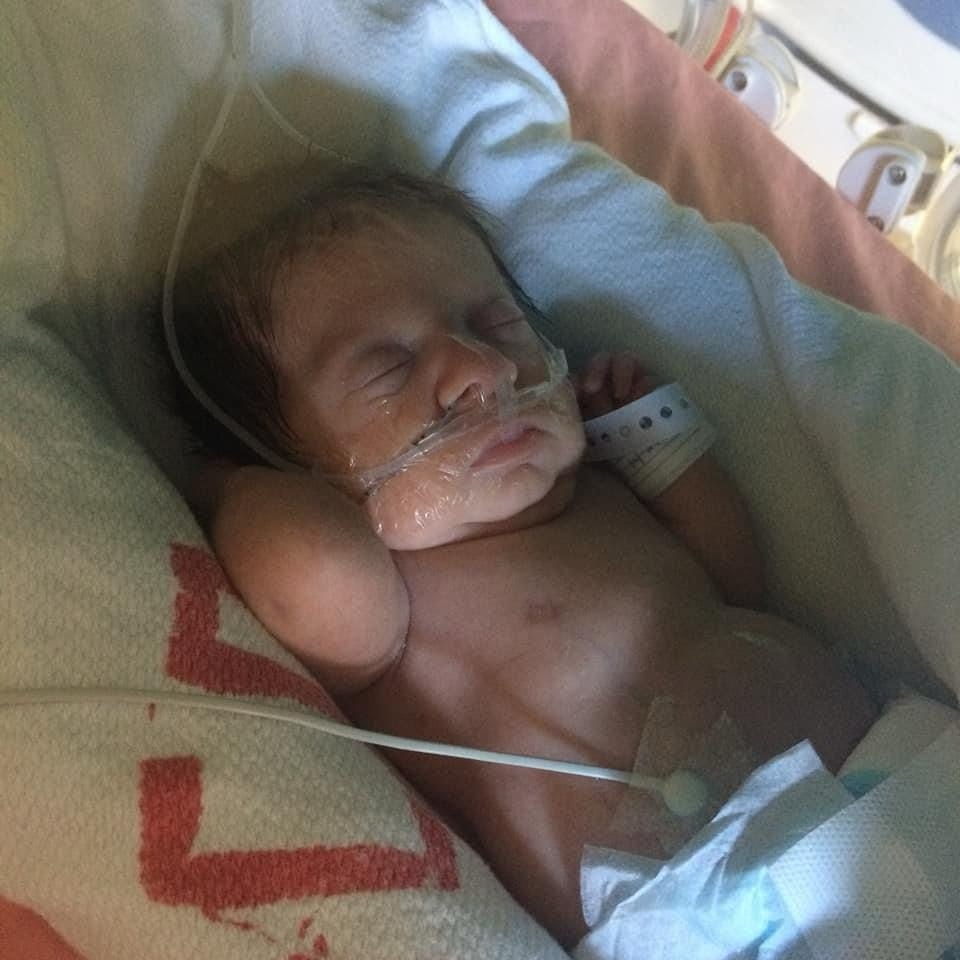 Gael Ramírez Tuly es un hermoso niño de 5 años quien nació con una rara enfermedad y por eso sus huesos no resisten mucho y se quiebran muy seguido