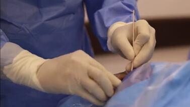 Medicina legal vuelve a extraer córneas en fallecidos para trasplantes