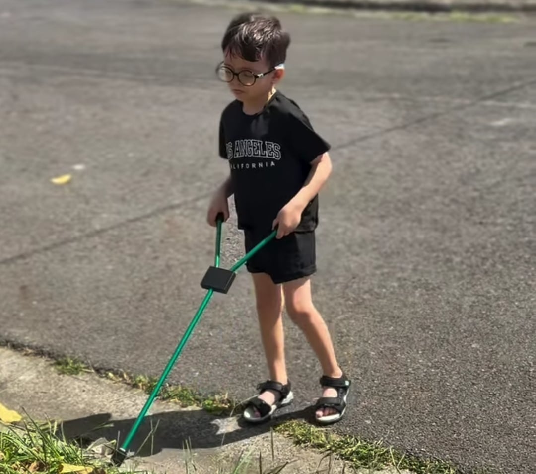 Samuel ocupa de un costoso tratamiento en Ecuador
