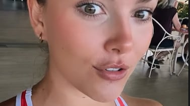 Lisbeth Valverde defiende una parte de su cuerpo que muchos le piden que se opere