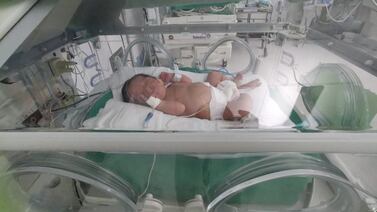 Matrimonio de Desamparados necesita ayuda urgente para salvar a su bebito de cuatro meses