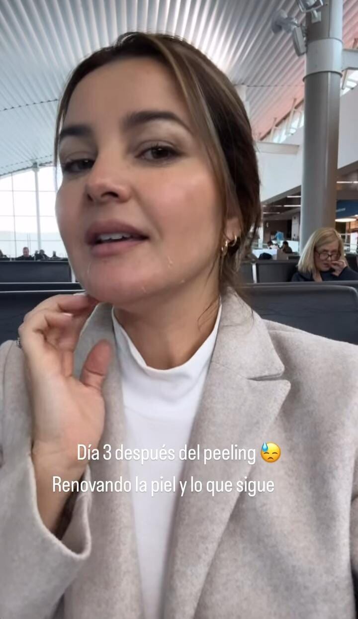 Shirley Álvarez está cambiando la piel de su cara