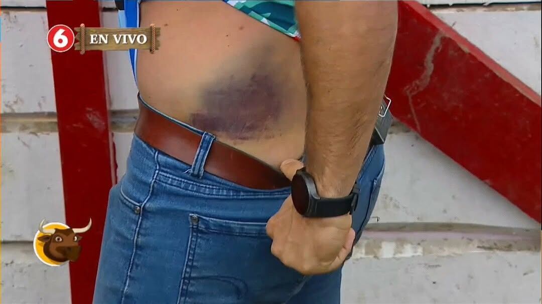 Ítalo Marenco enseñó en tele moretón que le quedó tras arriesgada jugada en Toros del 6