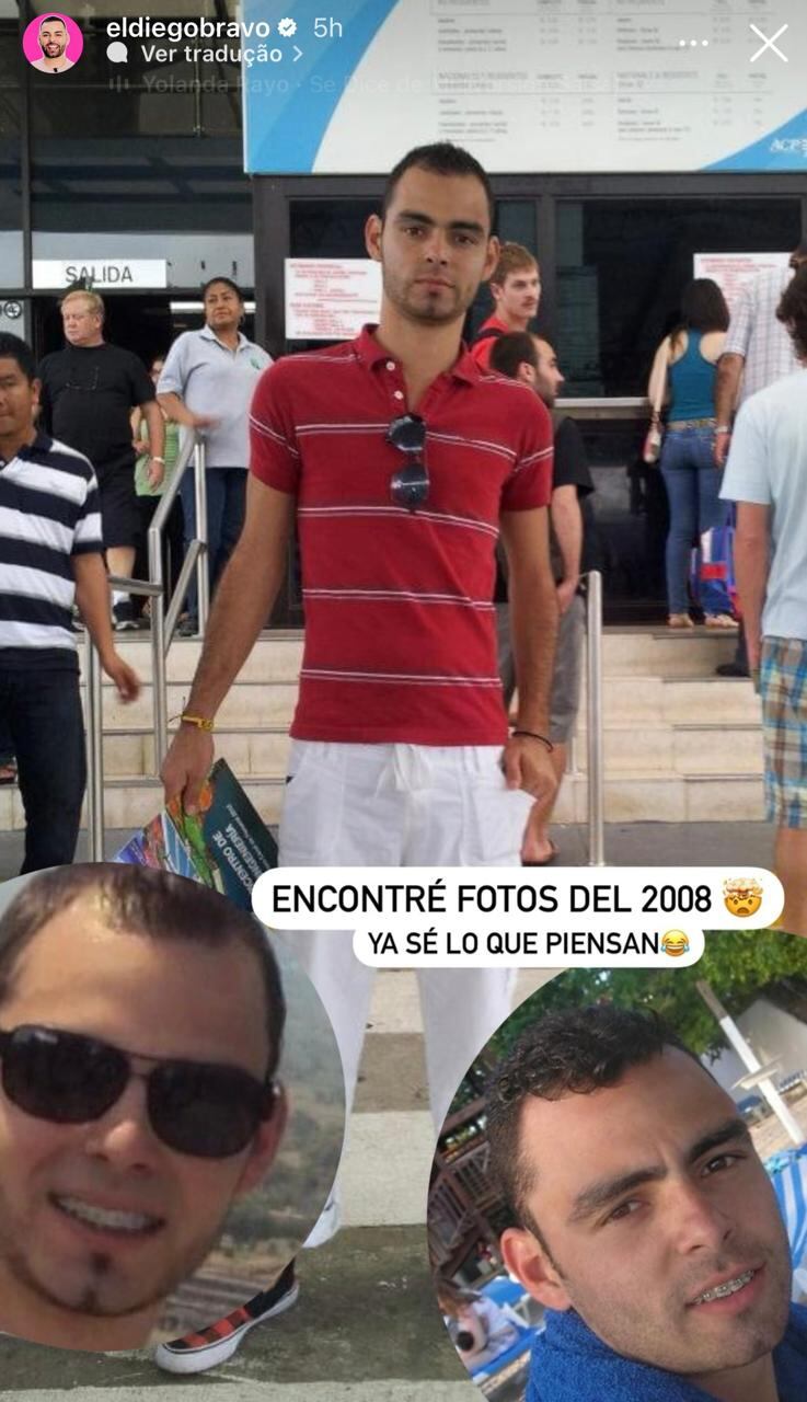 Diego Bravo arreglitos estéticos