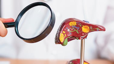 Virus de hepatitis pueden manifestarse después 10 ó 20 años