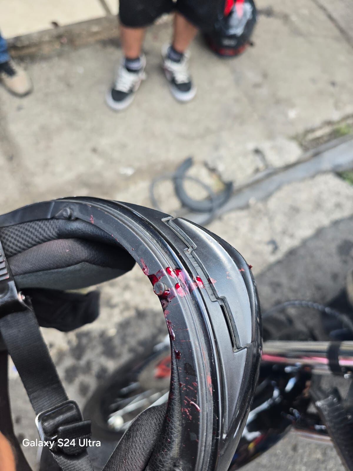 Hermanos denuncian agresión por parte de supuestos miembros de la Ultra. Foto cortesía Nicole Torres.