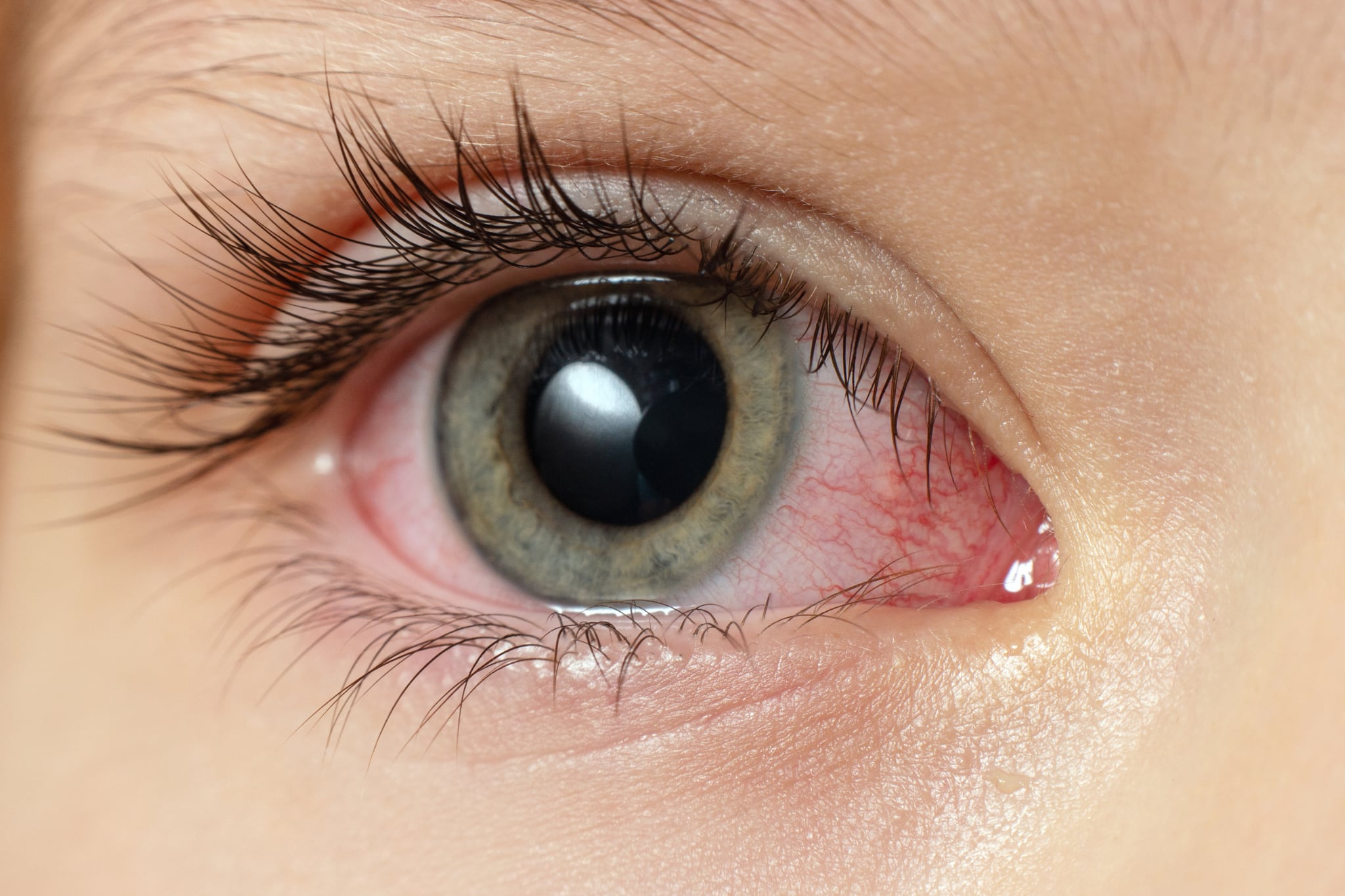 El uso de productos falsificados puede provocar riesgos para la salud ocular.