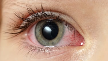 Alerta Sanitaria: Ministerio de Salud advierte sobre productos para los ojos