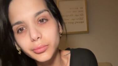 Coco Roper dio un último reporte sobre su estado de salud