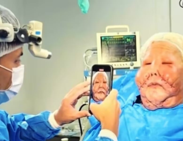 Juliana Oliveira inició cirugías reconstructivas tras sufrir una mala praxis en 2017.