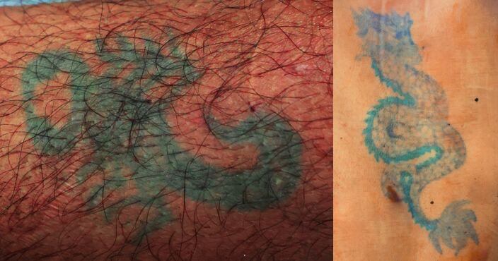 Estos son los tatuajes que serían claves para identificar al hombre atropellado.