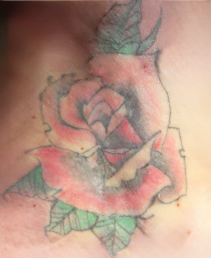 Tatuajes serían claves para identificar a mujer que falleció tras ser atropellada en Ipís.