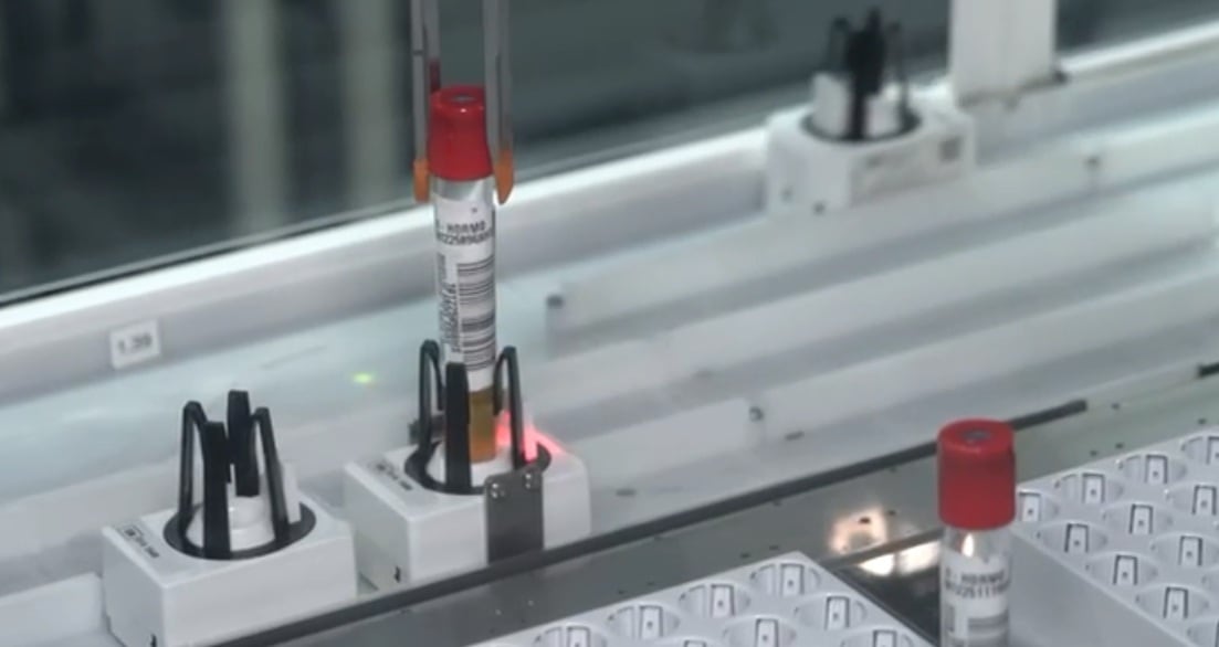 El hospital San Juan de Dios tiene un robot que se encarga de agilizar el sistema preanalítico de las muestras hormonales.