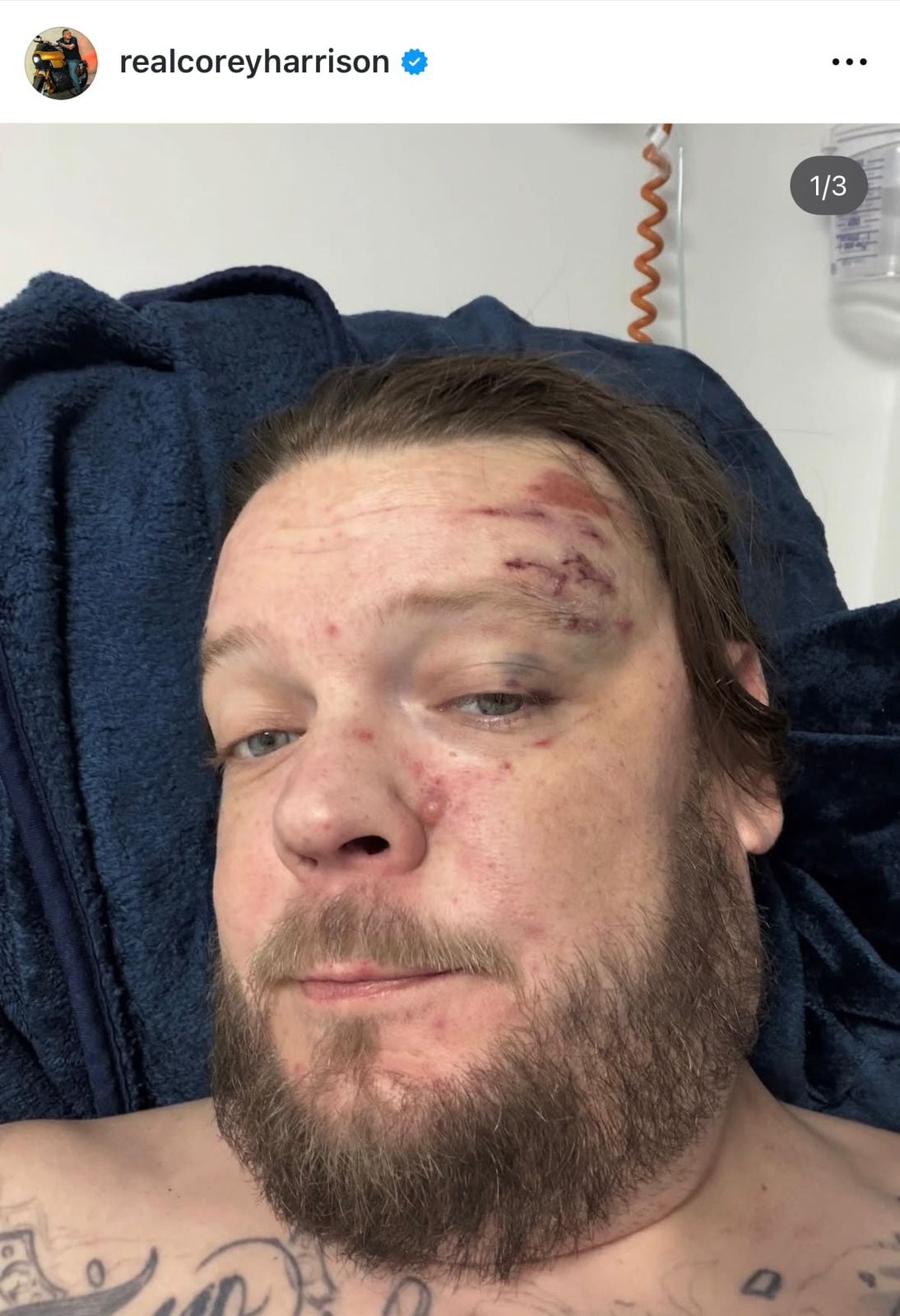 Instagram Corey Harrison