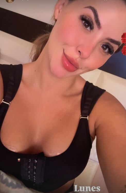 Keyla Sánchez mostró cómo le quedaron sus senos después del cambio de implantes.