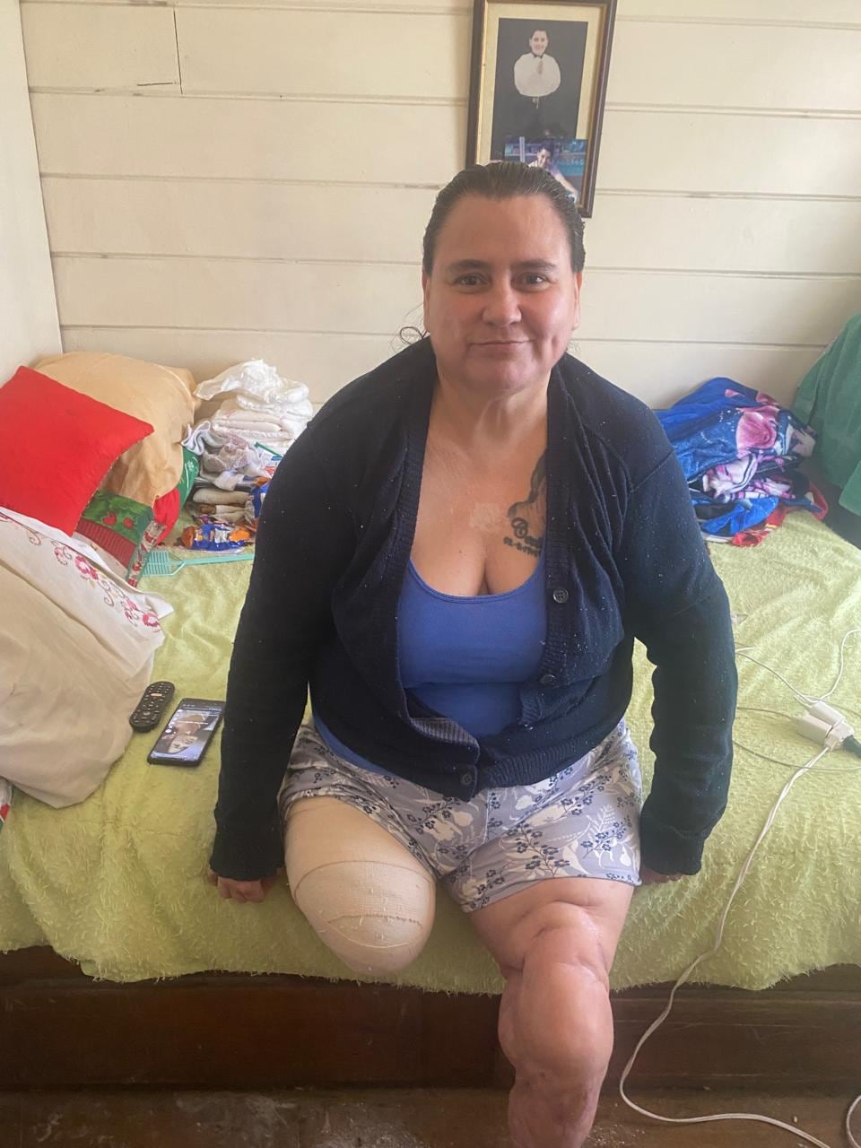 Grettel Chaves lleva 11 años luchando luego de un atropello