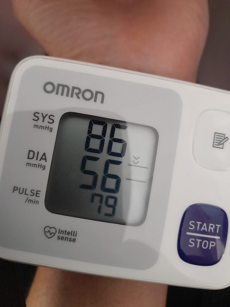 Así se mantiene la presión arterial de Arlene, diagnosticada con disautonomía hace más de 20 años.