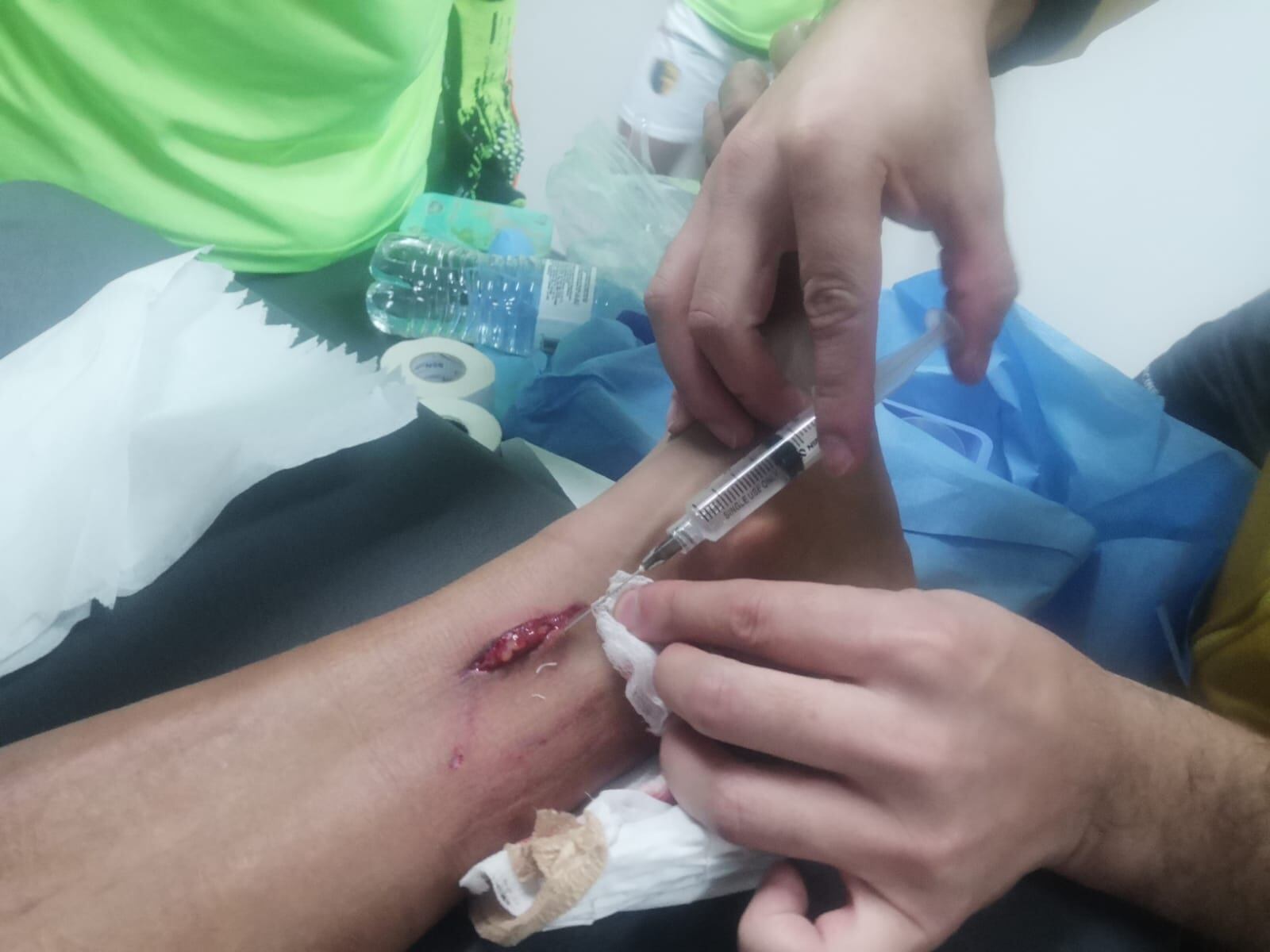 Así quedó pie de Marvin Angulo tras jugada con Douglas Sequeira