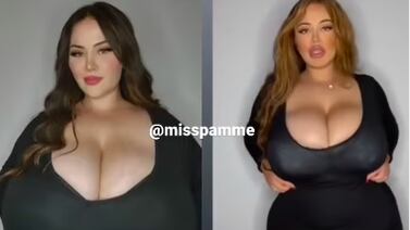 Modelo sufre extraña condición que hace que sus senos sigan creciendo