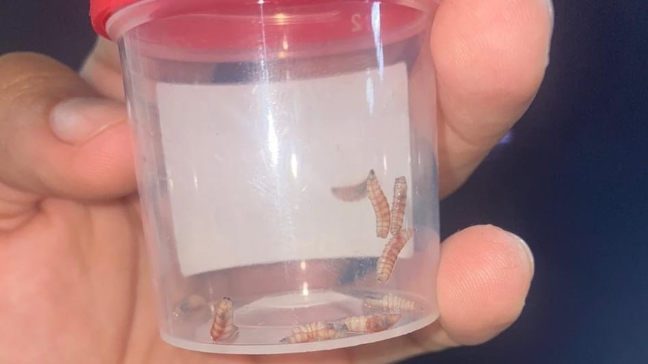 El gusano barrenador se confirmó en la boca de una muchacha de 19 años de Río Naranjo de Bagaces en Guanacaste, la  hermana, Vanessa Rojas Murillo, cuenta el calvario que vivieron en centros médicos de la Caja para que la atendieran.