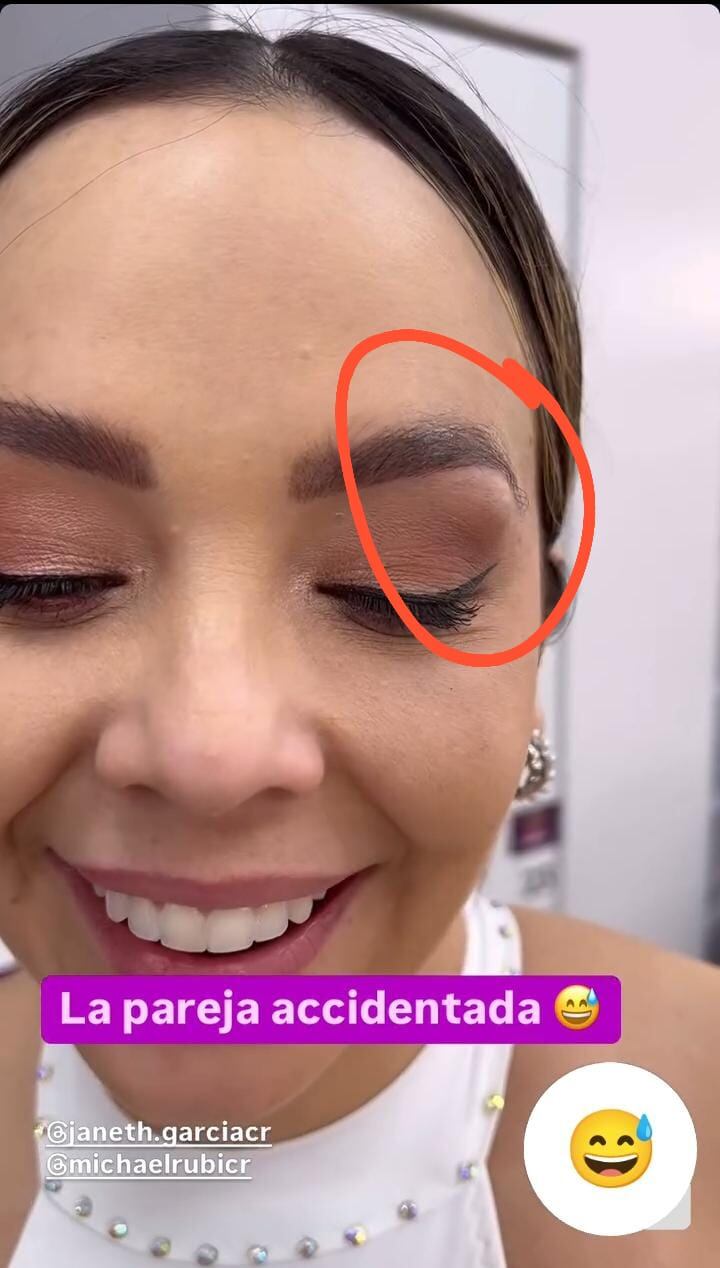 Así le quedó el ojo a Janeth García