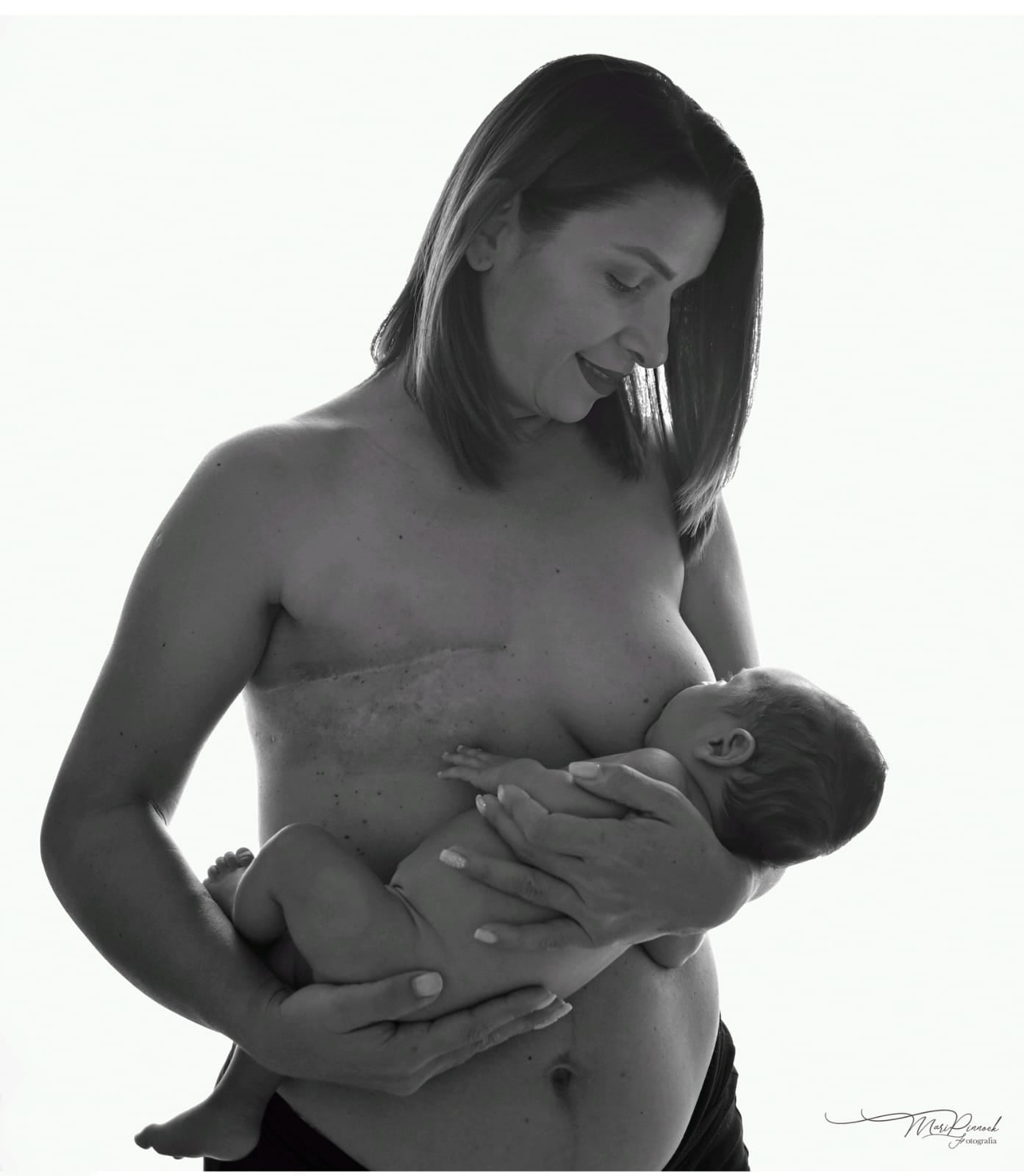 Pacientes del hospital Max Terán de Quepos son las protagonistas de una emotiva exposición en relación al cáncer de mama.