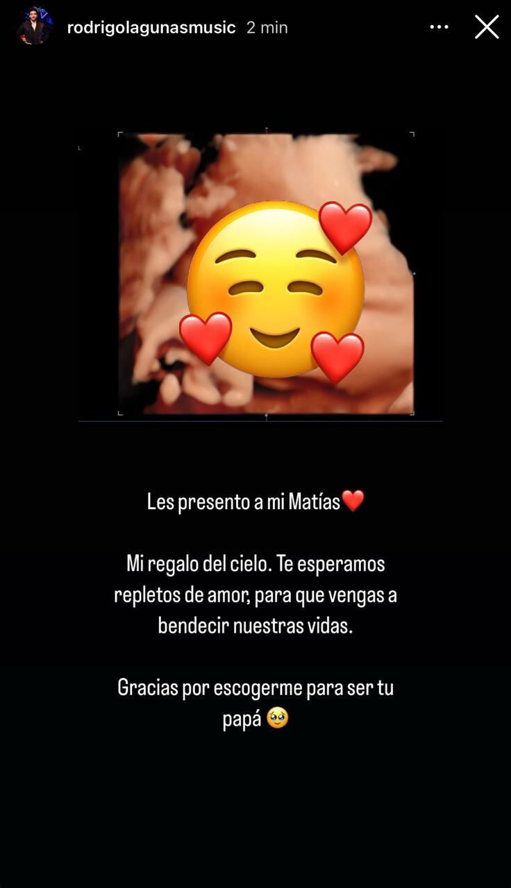 El cantante Rodrigo Lagunas emocionó a sus seguidores este viernes con la noticia que dio pasadas las 9 de la noche.