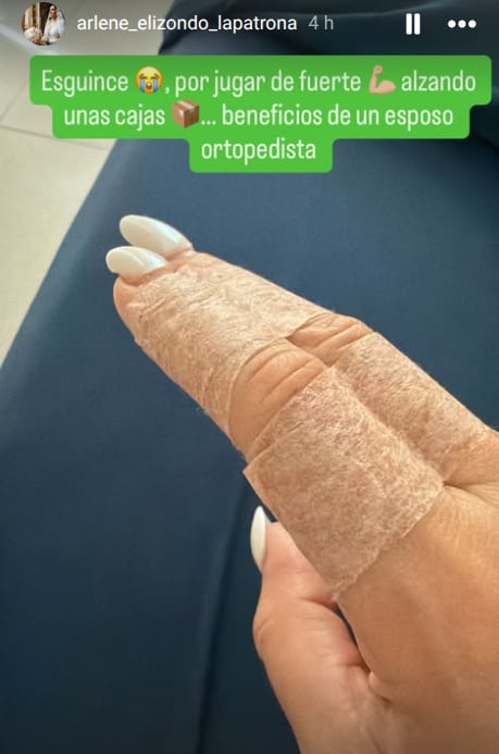 La cantante Arlene Elizondo terminó lesionada a pocos días de cumplir un mes de casada.