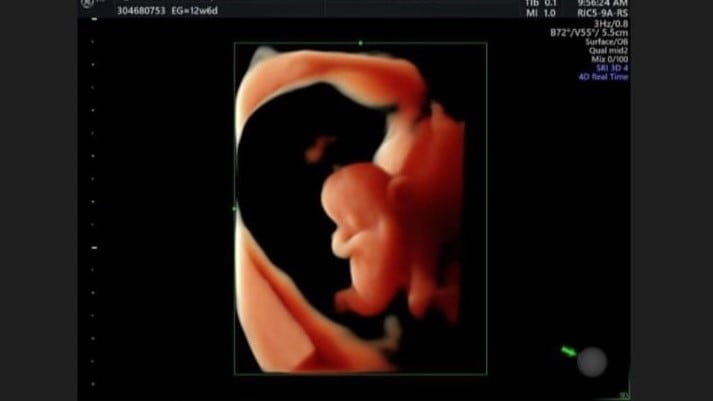 Luis Ronaldo Araya anunció que se convertirá en papá. Instagram.