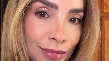 Ericka Morera encontró en el bótox la solución a un problema que la tenía sufriendo