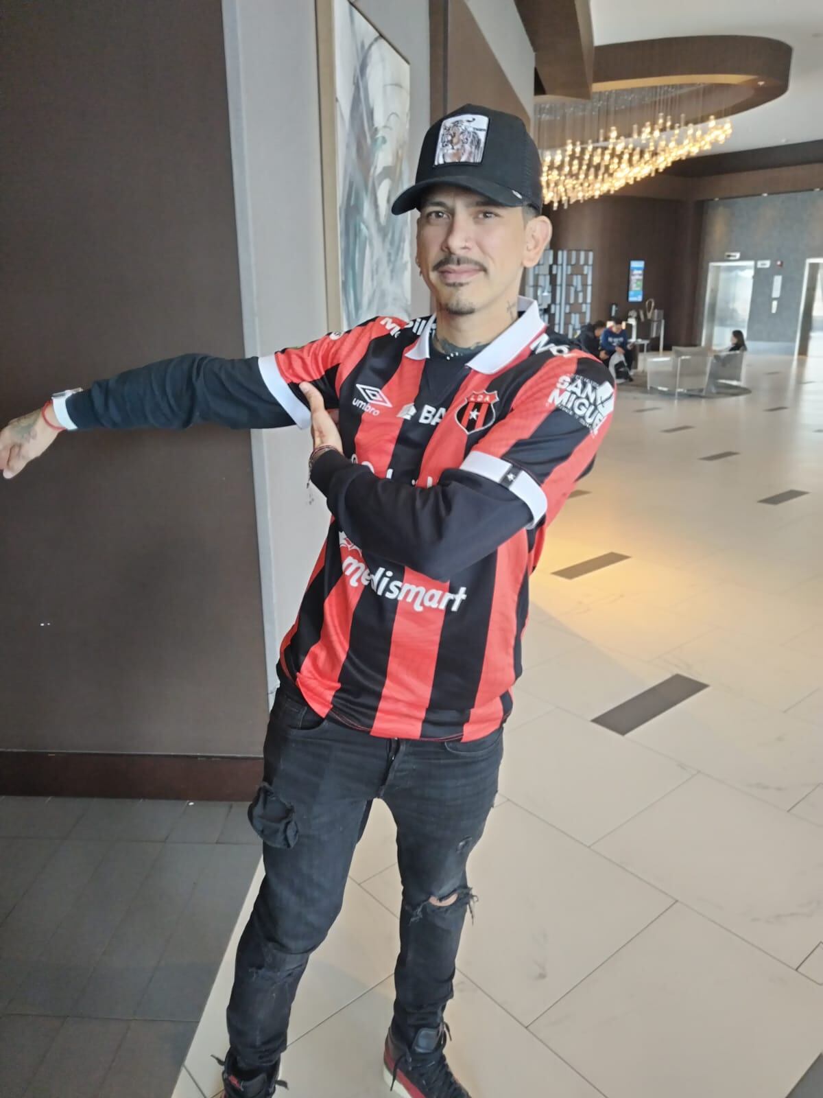 Herson Torres Cabezas, sobreviviente de tres balazos para robarle un celular. Vive en Manhattan