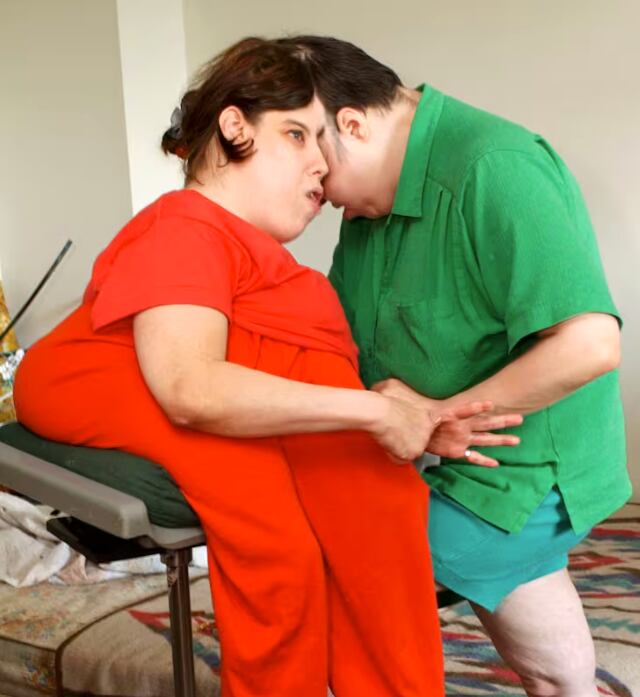 Los siameses Lori y George Schappell.