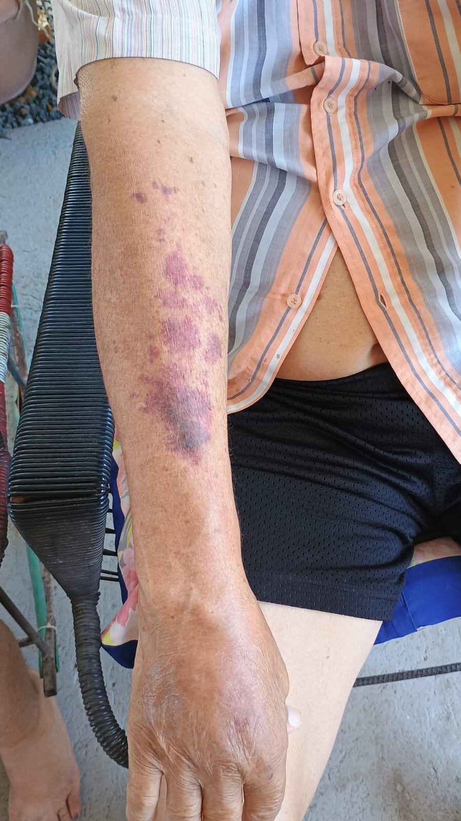 Matrimonio de adultos mayores agredidos en Santa Cruz. Foto cortesía.