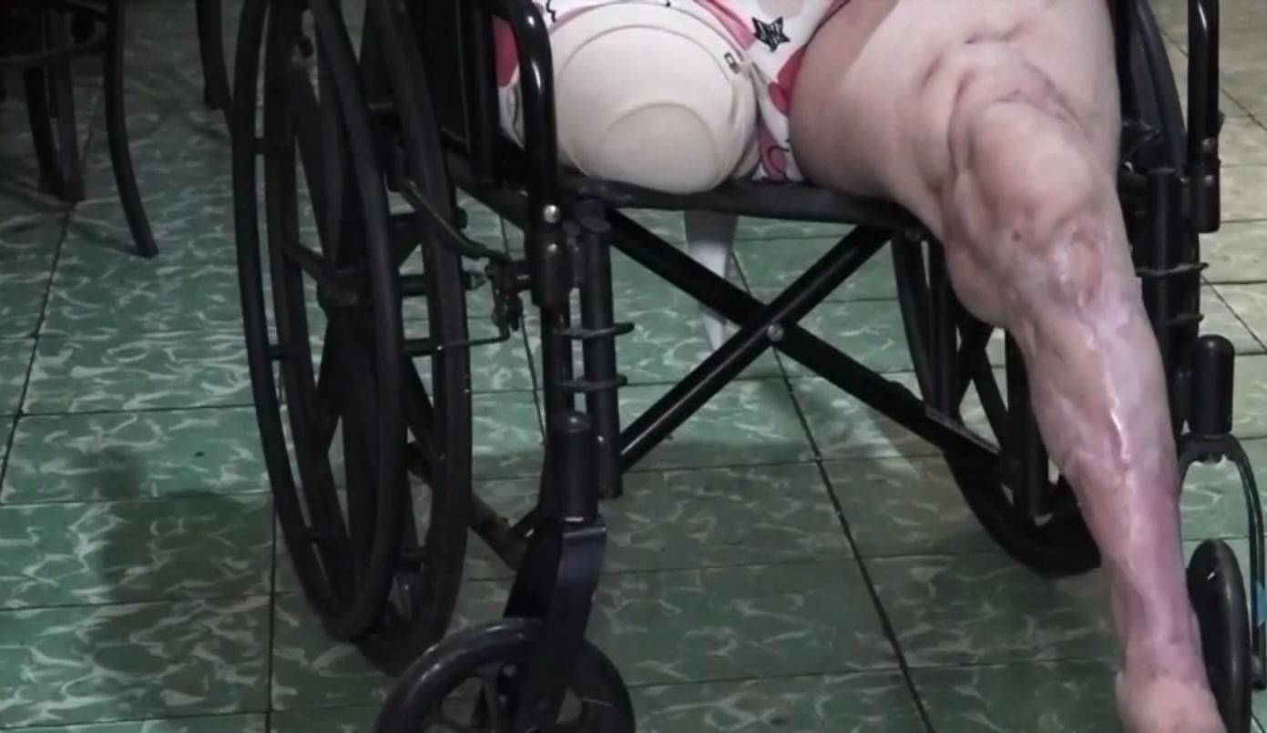 Grettel Chaves lleva 11 años luchando luego de un atropello