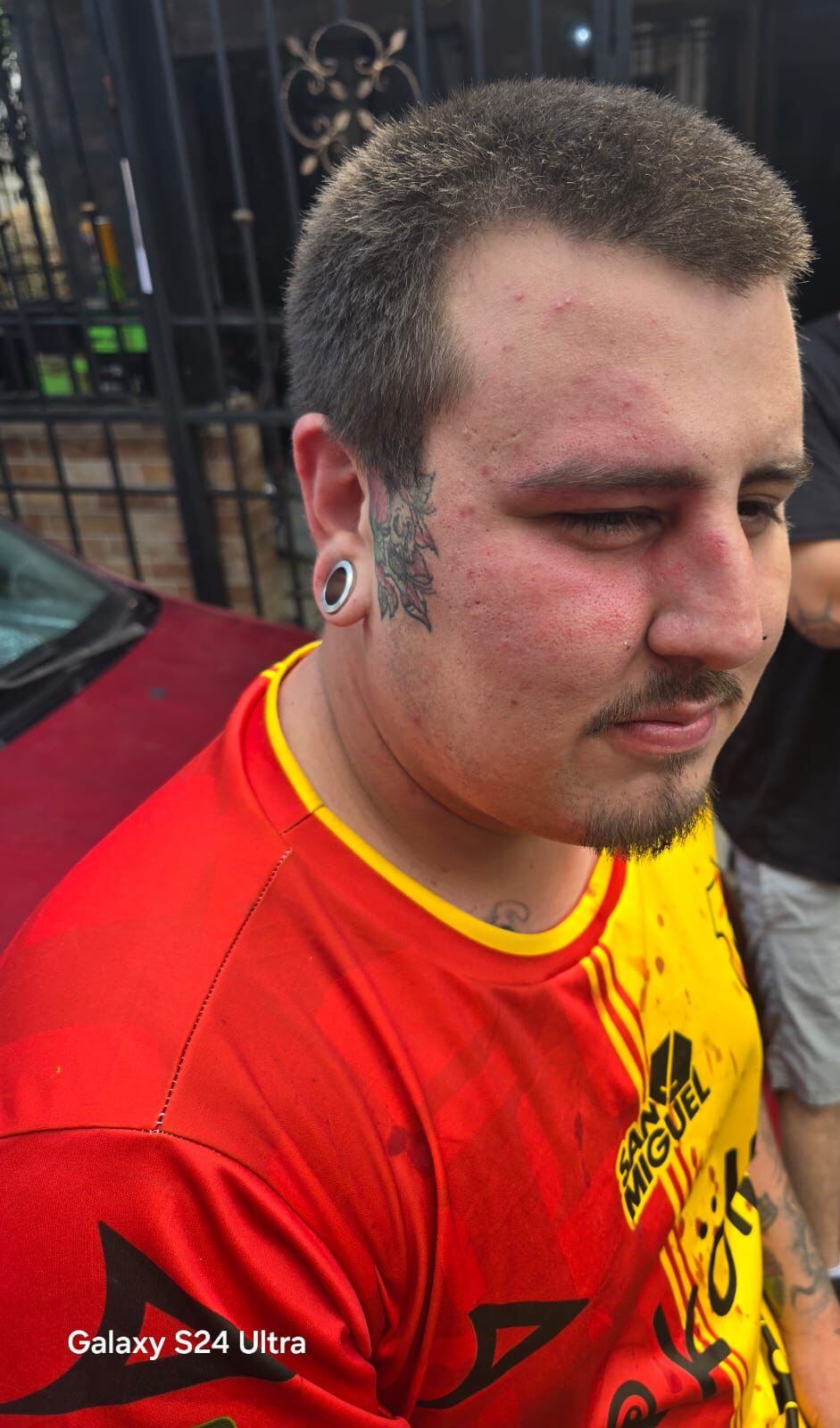 Hermanos denuncian agresión por parte de supuestos miembros de la Ultra. Foto cortesía Nicole Torres.