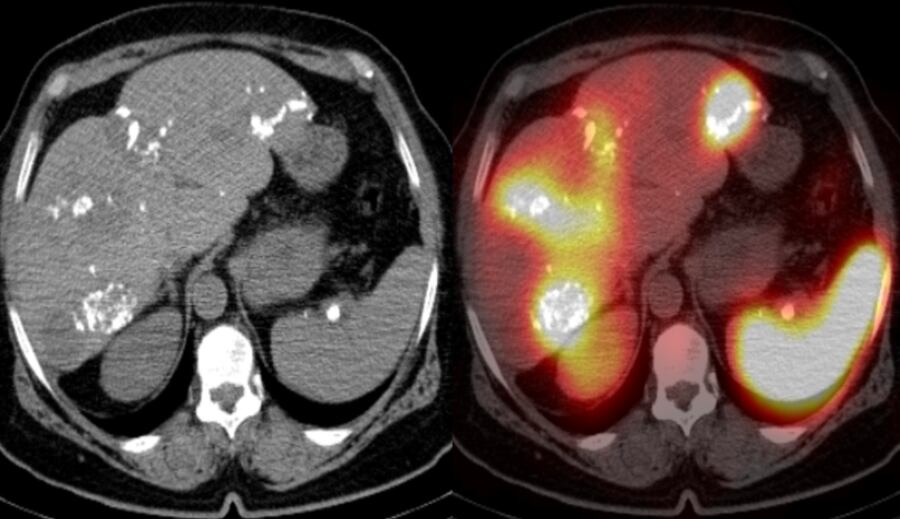 El tico, David Alberto Gutiérrez Albenda, tiene 34 años, es de San Rafael Debajo de Desamparados y es doctor especialista en una de las áreas de mayor dificultad en el campo de la salud: la medicina nuclear. En la foto con su esposa, Lissette Monge Abarca, y su hijo, desde el 1 de febrero del año pasado, Théo André Albenda Monge.