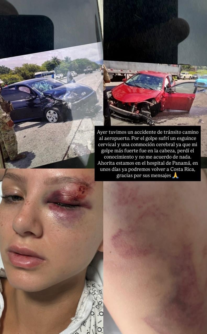 reina de belleza
accidenete