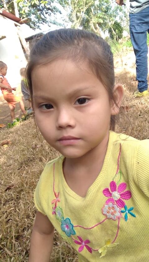 Niña que sufrió accidente con picadora de zacate en Guatuso. foto cortesía Wilfredo Hernández.